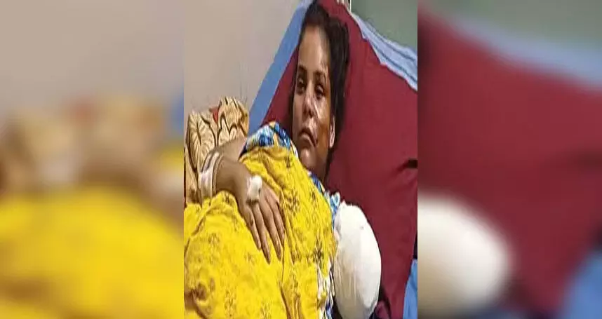 सावधान : महिला का हाथ उखड़कर बाइक की चेन से ही लटका, बाइक पर बैठते समय सावधानी बरतें..