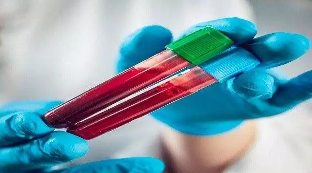 बड़ी लापरवाही से हड़कंप, अस्पताल ने ये क्या कर दिया