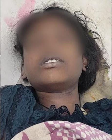 SUSCIDE : फटकार से आहत किशोरी ने लगाई फांसी… परिवार में मातम