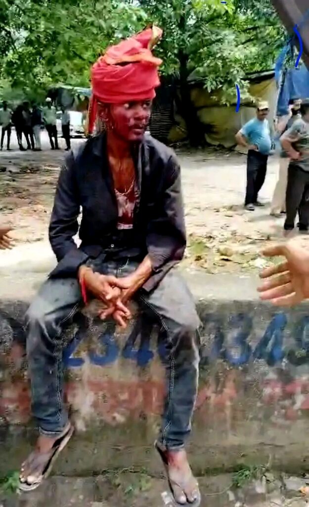 JAMSHEDPUR CRIME : टेल्को में युवक पर चापड़ से हमला, हालत गंभीर