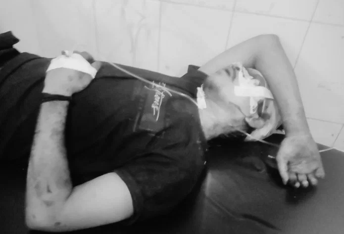 JAMSHEDPUR : बारीगोड़ा में युवक पर जानलेवा हमला, चापड़ और पत्थर से किया लहूलुहान…..