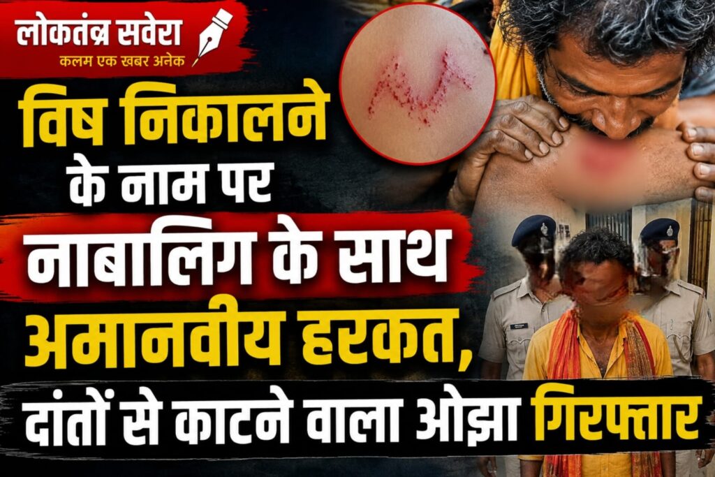 विष निकालने के नाम पर नाबालिग के साथ अमानवीय हरकत, दांतों से काटने वाला ओझा गिरफ्तार