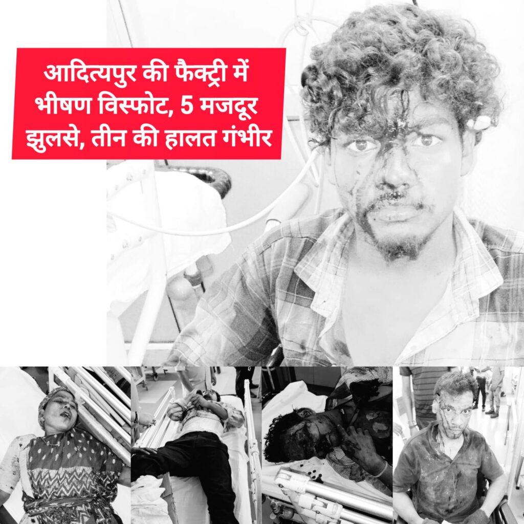 BREAKING : आदित्यपुर की फैक्ट्री में भीषण विस्फोट, 5 मजदूर झुलसे…. तीन की हालत गंभीर…