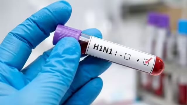 झारखंड में H1N1 की दस्तक, 24 लोगों में स्वाइन फ्लू की पुष्टि; स्वास्थ्य विभाग अलर्ट